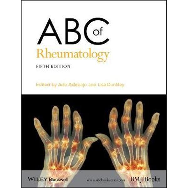 ABC of Rheumatology