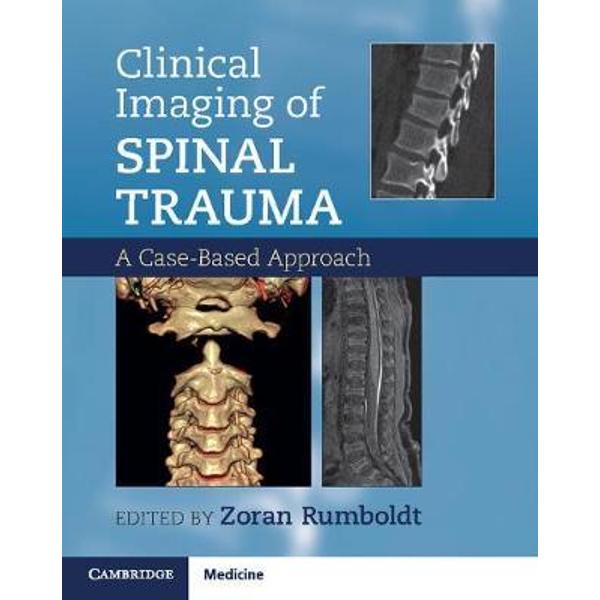 Clinical Imaging of Spinal Trauma