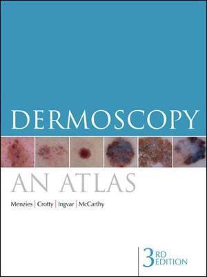 Dermoscopy: An Atlas