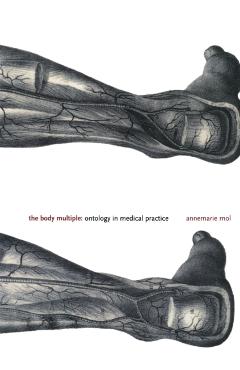 Body Multiple