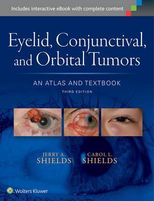 Eyelid, Conjunctival, and Orbital Tumors: An Atlas and Textb