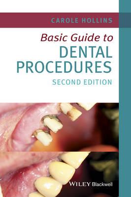 Basic Guide to Dental Procedures - Carole Hollins