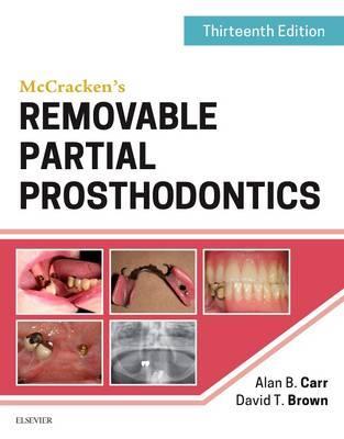 McCracken's Removable Partial Prosthodontics - Alan Carr