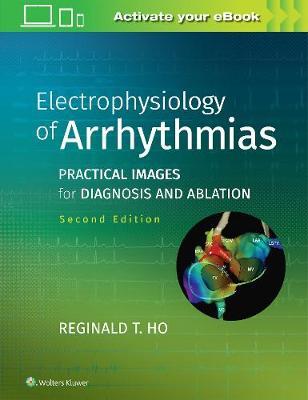 Electrophysiology of Arrhythmias - Reginald T Ho