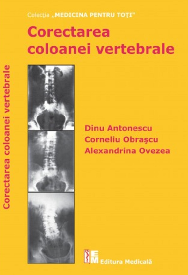 Corectarea coloanei vertebrale - Dinu Antonescu