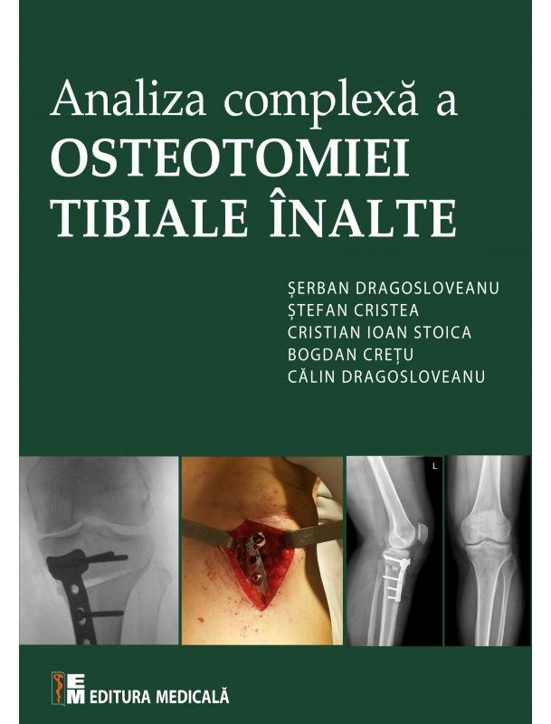 Analiza complexa a Osteotomiei Tibiale Inalte - Serban Dragosloveanu