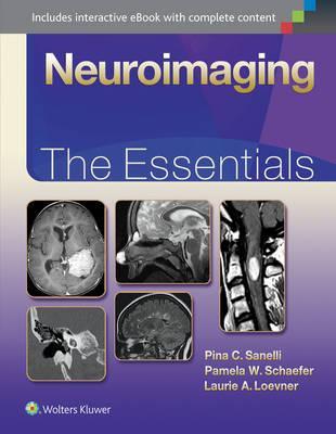 Neuroimaging: The Essentials - Pina Sanelli