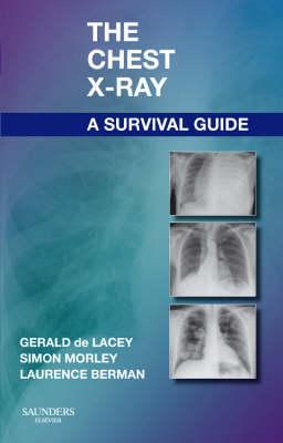 Chest X-Ray: A Survival Guide - Gerald De Lacey