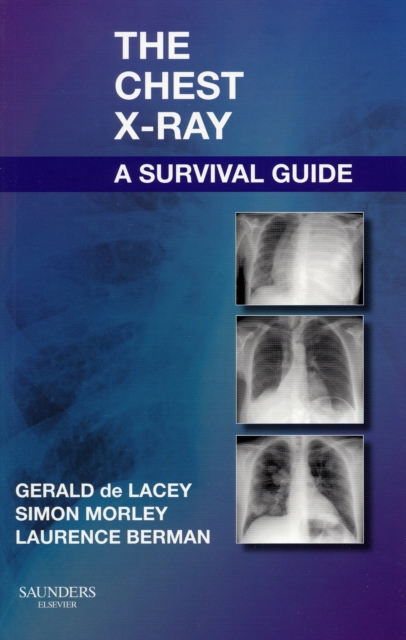 Chest X-Ray: A Survival Guide - Gerald De Lacey