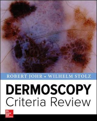 Dermoscopy  Criteria Review - Robert Johr