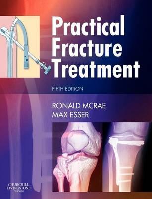 Practical Fracture Treatment - Ronald McRae