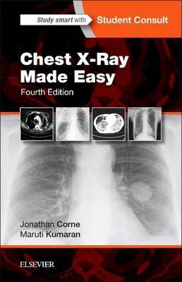 Chest X-Ray Made Easy - Jonathan Corne