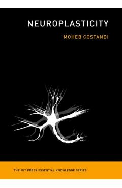 Neuroplasticity