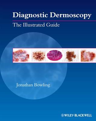 Diagnostic Dermoscopy - Jonathan Bowling