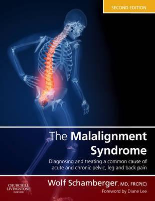 Malalignment Syndrome - Wolf Schamberger