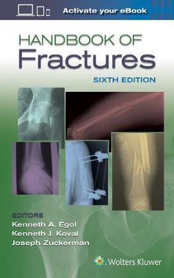 Handbook of Fractures -  Egol