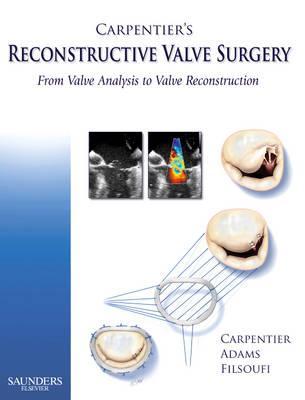 Carpentier's Reconstructive Valve Surgery - Alain Carpentier