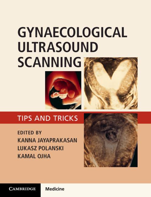 Gynaecological Ultrasound Scanning - Kanna Jayaprakasan