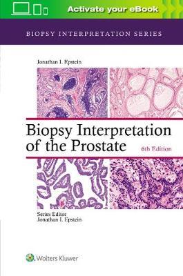 Biopsy Interpretation of the Prostate - Jonathan I Epstein