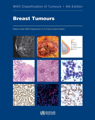 Breast Tumours - Who Classification Of Tumours Editorial