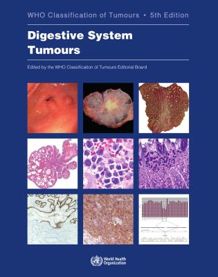 Digestive System Tumours - Who Classification Of Tumours Editorial