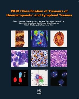 WHO Classification of Tumours of Haematopoietic and Lymphoid Tissues - Who Classification Of Tumours Editorial