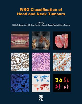 WHO Classification of Head and Neck Tumours - Who Classification Of Tumours Editorial