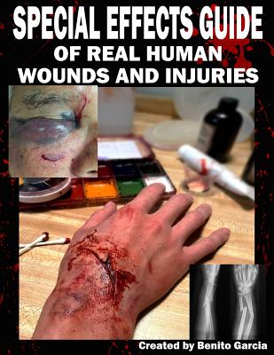 Special Effects Guide Of Real Human Wounds and Injuries: Special Effects Guide Of Real Human Wounds and Injuries - Benito Garcia Iii