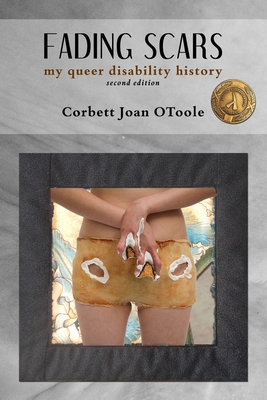 Fading Scars: My Queer Disability History, 2nd Edition - Corbett Joan Otoole