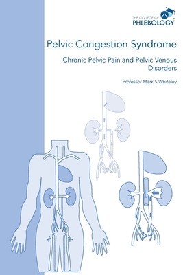 Pelvic Congestion Syndrome - Chronic Pelvic Pain and Pelvic Venous Disorders - Mark S. Whiteley