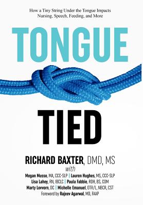 Tongue-Tied: How a Tiny String Under the Tongue Impacts Nursing, Speech, Feeding, and More - Dmd Richard Baxter
