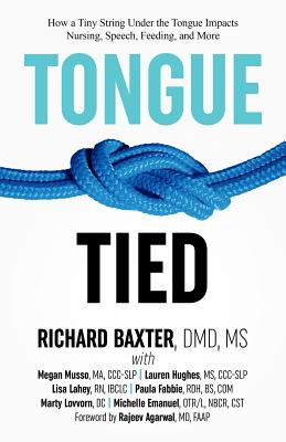 Tongue-Tied: How a Tiny String Under the Tongue Impacts Nursing, Speech, Feeding, and More - Dmd Baxter