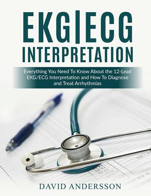 EKG/ECG Interpretation: Everything you Need to Know about the 12-Lead ECG/EKG Interpretation and How to Diagnose and Treat Arrhythmias - Medical Creations