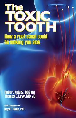 The Toxic Tooth: How a root canal could be making you sick - Dds Robert Kulacz
