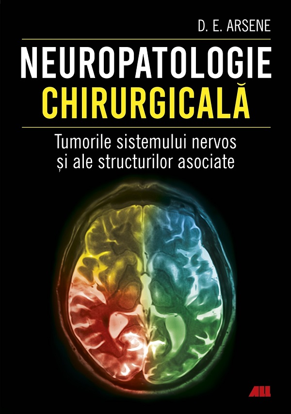 Neuropatologie chirurgicala. Tumorile sistemului nervos - Dr. Dorel Eugen Arsene