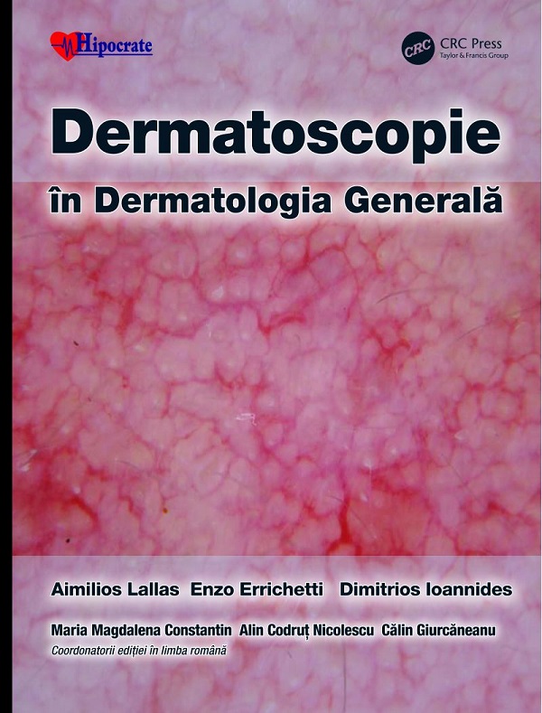Dermatoscopie in Dermatologia Generala - Aimilios Lallas, Enzo Errichetti, Dimitrios Ioannides