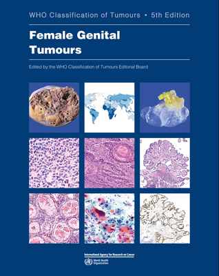 Female Genital Tumours: Who Classification of Tumours - Who Classification Of Tumours Editorial