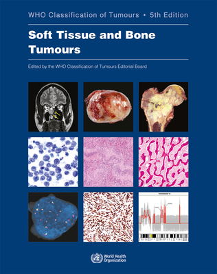 Soft Tissue and Bone Tumours: Who Classification of Tumours - Who Classification Of Tumours Editorial