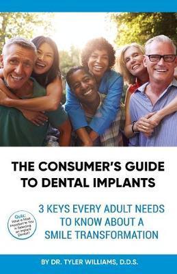 The Consumer's Guide to Dental Implants: 3 Keys Every Adult Needs to Know About A Smile Transformation - Tyler Williams