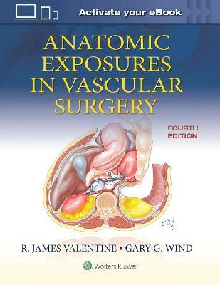 Anatomic Exposures in Vascular Surgery - Wind Gary G.