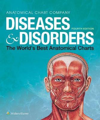 Diseases & Disorders: The World's Best Anatomical Charts - Anatomical Chart Company