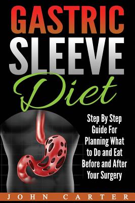 Gastric Sleeve Diet: Step By Step Guide For Planning What to Do and Eat Before and After Your Surgery - John Carter