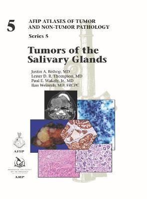 Tumors of the Salivary Glands: Series 5 - Justin A. Bishop