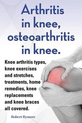 Arthritis in knee, osteoarthritis in knee. Knee arthritis types, knee exercises and stretches, treatments, home remedies, knee replacements and knee b - Robert Rymore