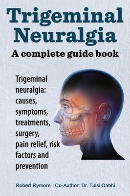 Trigeminal neuralgia: a complete guide book. Trigeminal neuralgia: causes, symptoms, treatments, surgery, - Robert Rymore