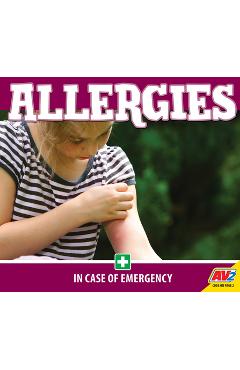 Coperta cărții 'Allergies - Helen Lepp Friesen'