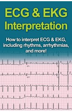 ECG & EKG Interpretation: How to interpret ECG & EKG, including rhythms, arrhythmias, and more! - Jeremy Pine