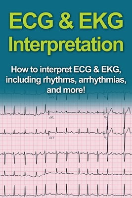ECG & EKG Interpretation: How to interpret ECG & EKG, including rhythms, arrhythmias, and more! - Jeremy Pine