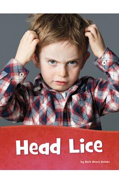Coperta cărții 'Head Lice - Beth Bence Reinke'