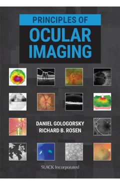 Coperta cărții 'Principles of Ocular Imaging - Daniel Gologorsky'